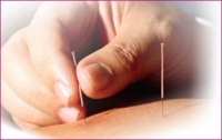 Accupuncture  Health & Beauty